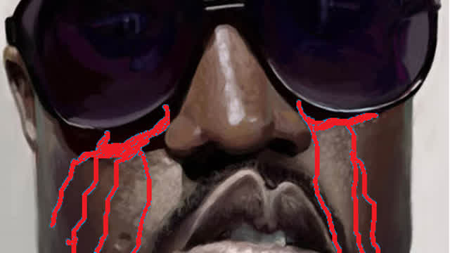 How I Injured Myself - "Animated"! How I Injured Myself - "Animated"!