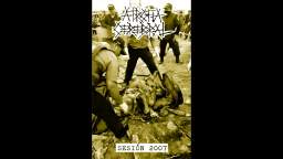 ATROFIA CEREBRAL – ¡MUERE! (SESIÓN 2007) NOISECORE